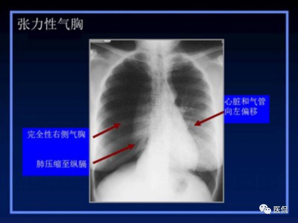 (医学ppt课件大全)(医学ppt模板免费)