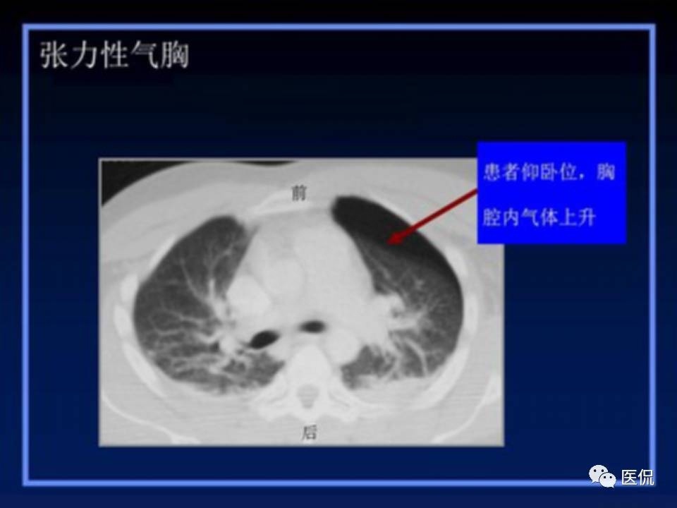 (医学ppt课件大全)(医学ppt模板免费)