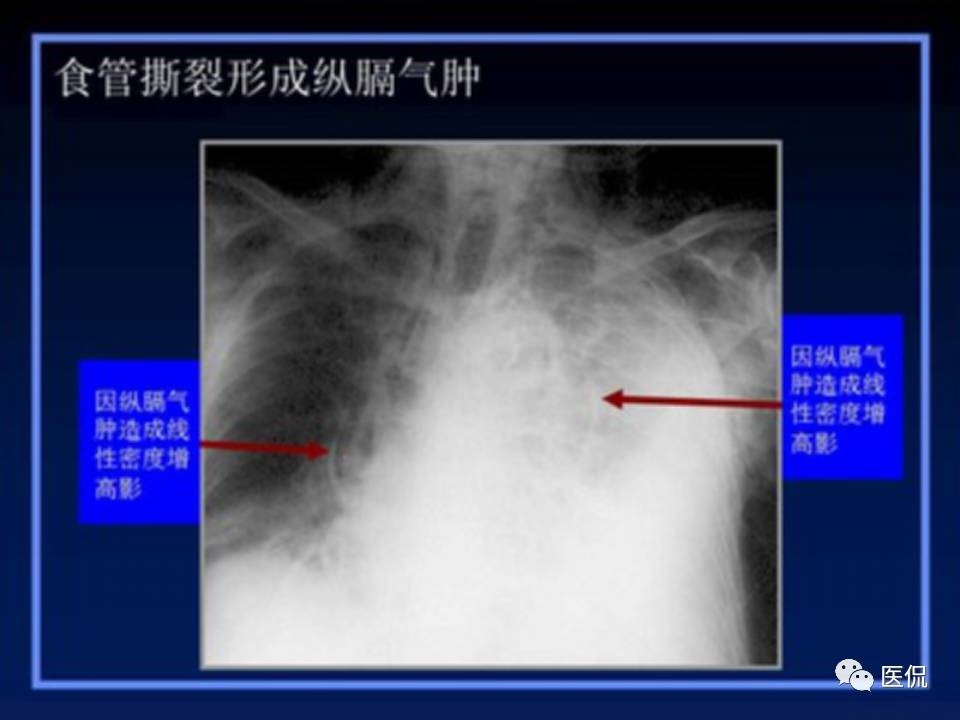 (医学ppt课件大全)(医学ppt模板免费)