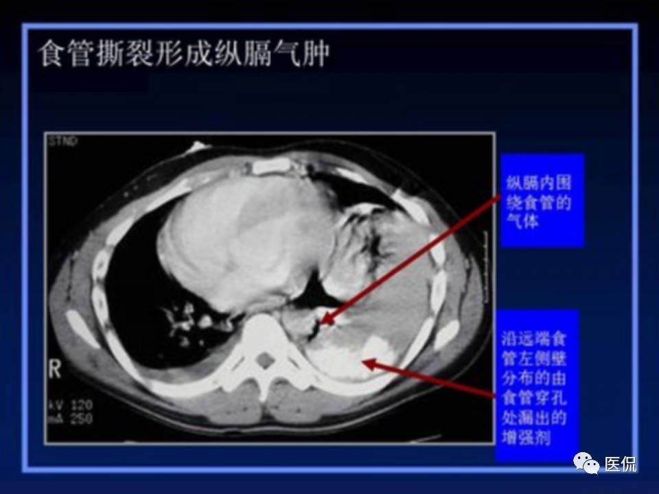 (医学ppt课件大全)(医学ppt模板免费)