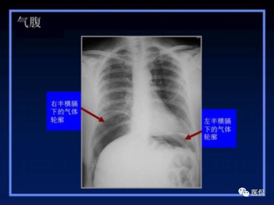 (医学ppt课件大全)(医学ppt模板免费)