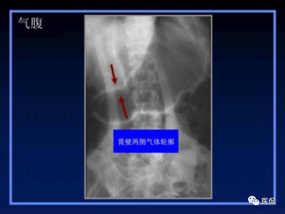 (医学ppt课件大全)(医学ppt模板免费)