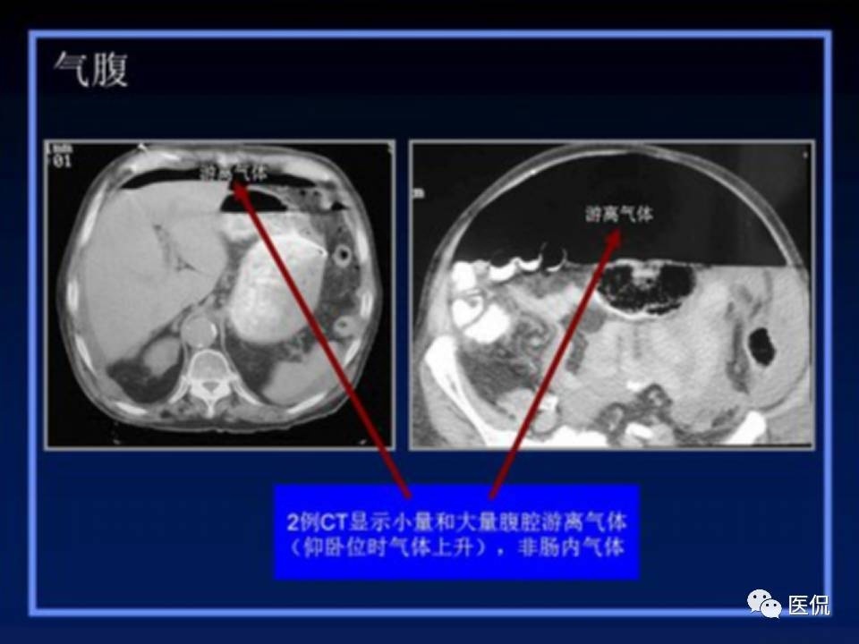 (医学ppt课件大全)(医学ppt模板免费)