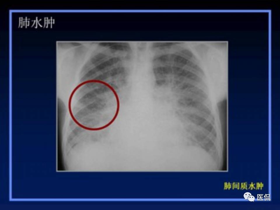 (医学ppt课件大全)(医学ppt模板免费)