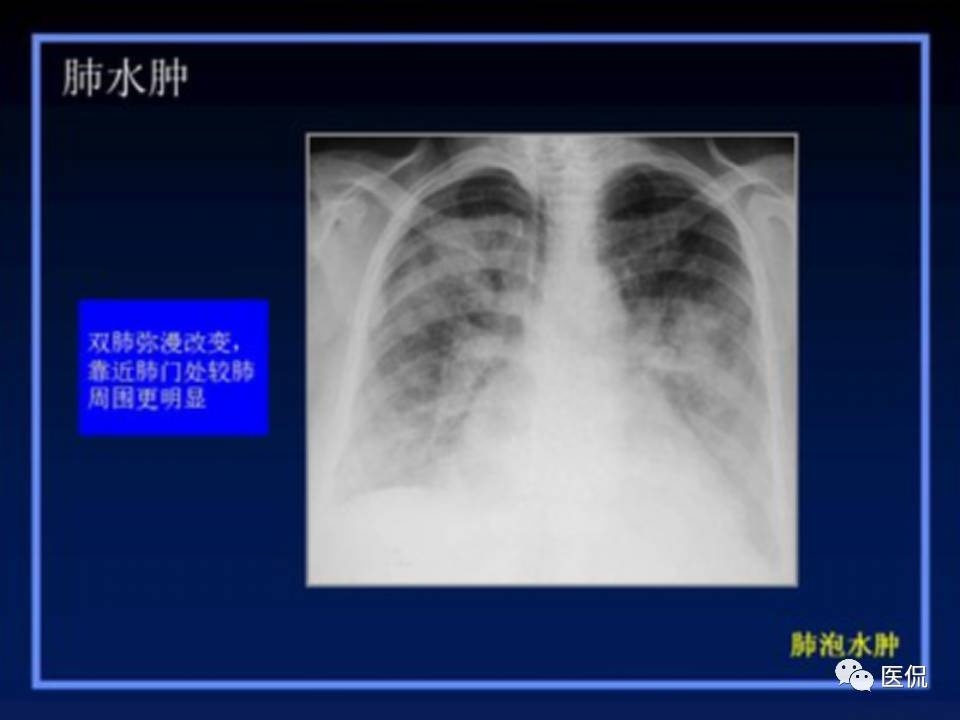 (医学ppt课件大全)(医学ppt模板免费)