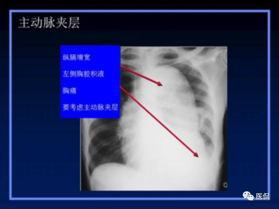 (医学ppt课件大全)(医学ppt模板免费)