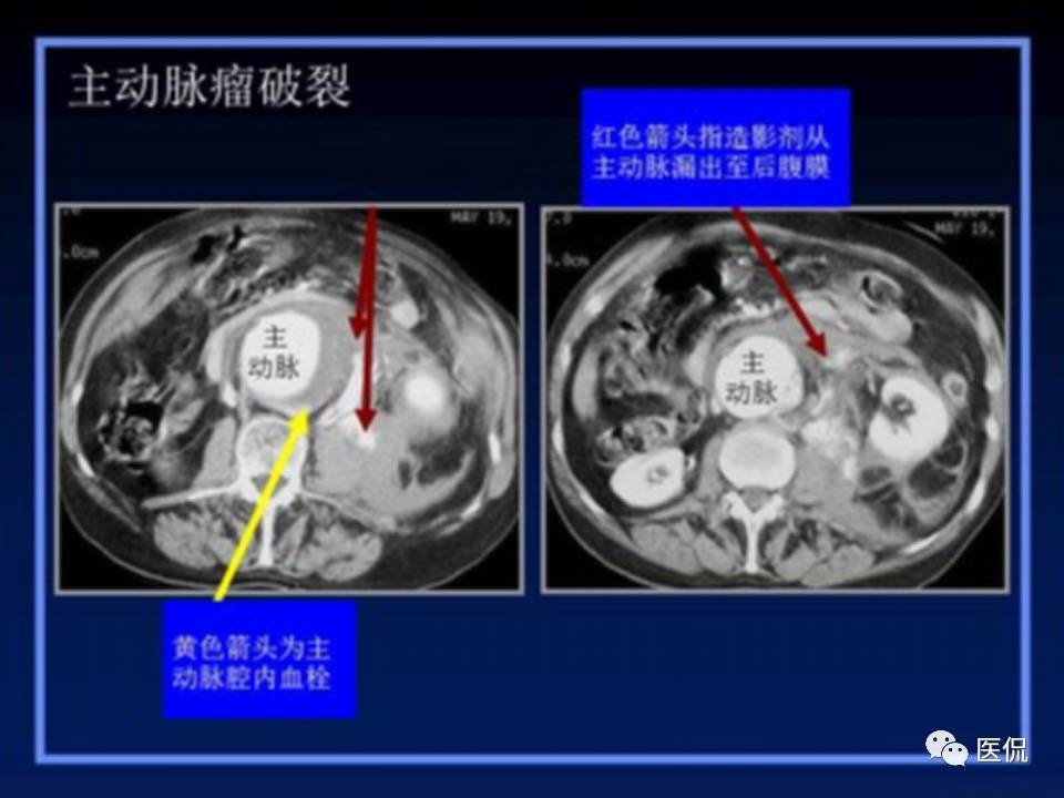 (医学ppt课件大全)(医学ppt模板免费)