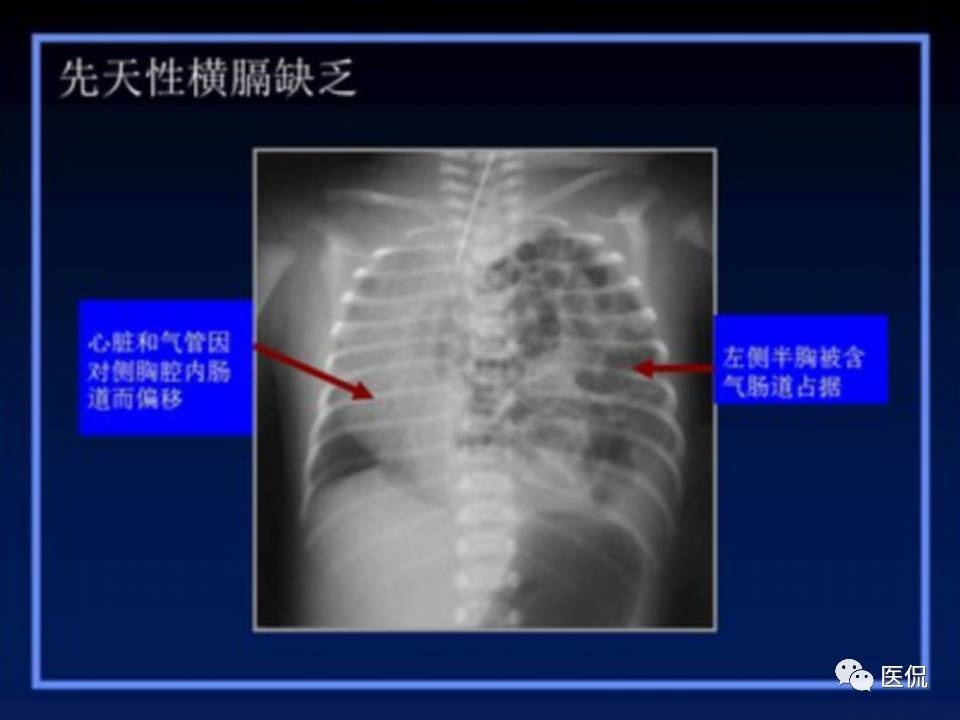 (医学ppt课件大全)(医学ppt模板免费)