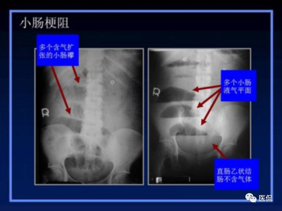 (医学ppt课件大全)(医学ppt模板免费)