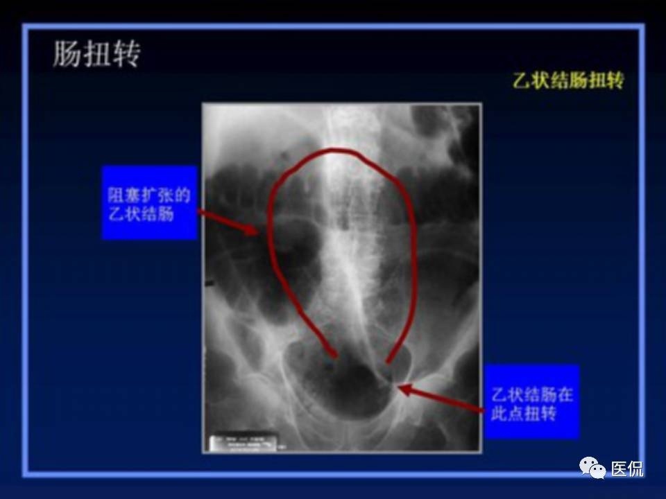 (医学ppt课件大全)(医学ppt模板免费)