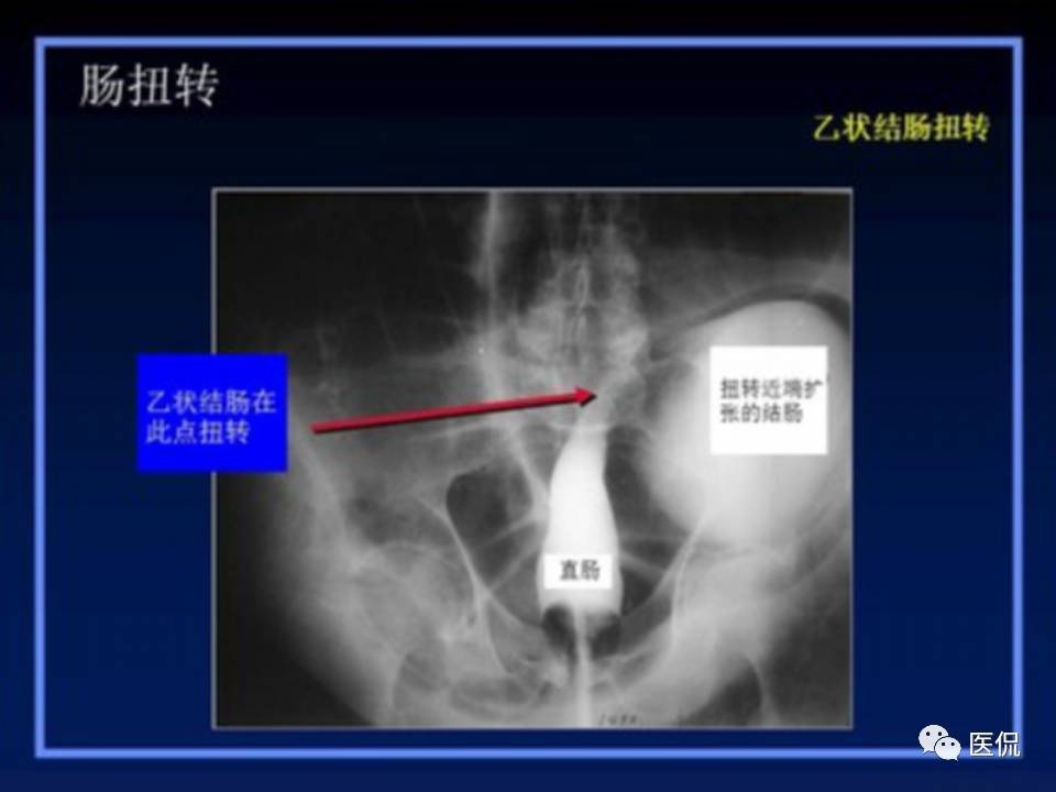 (医学ppt课件大全)(医学ppt模板免费)