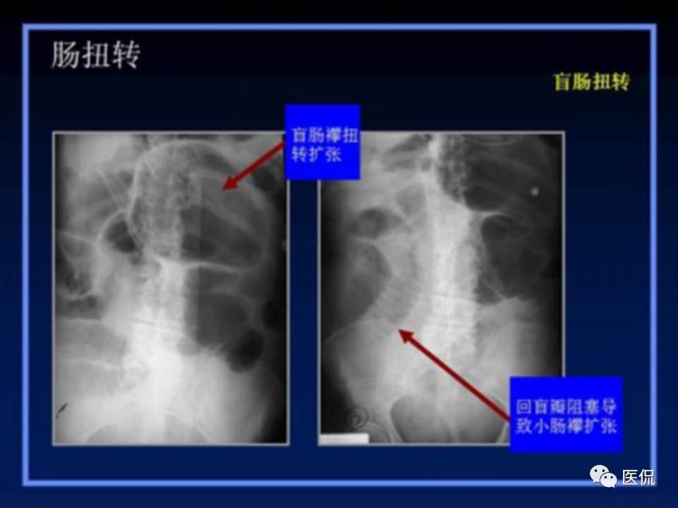 (医学ppt课件大全)(医学ppt模板免费)