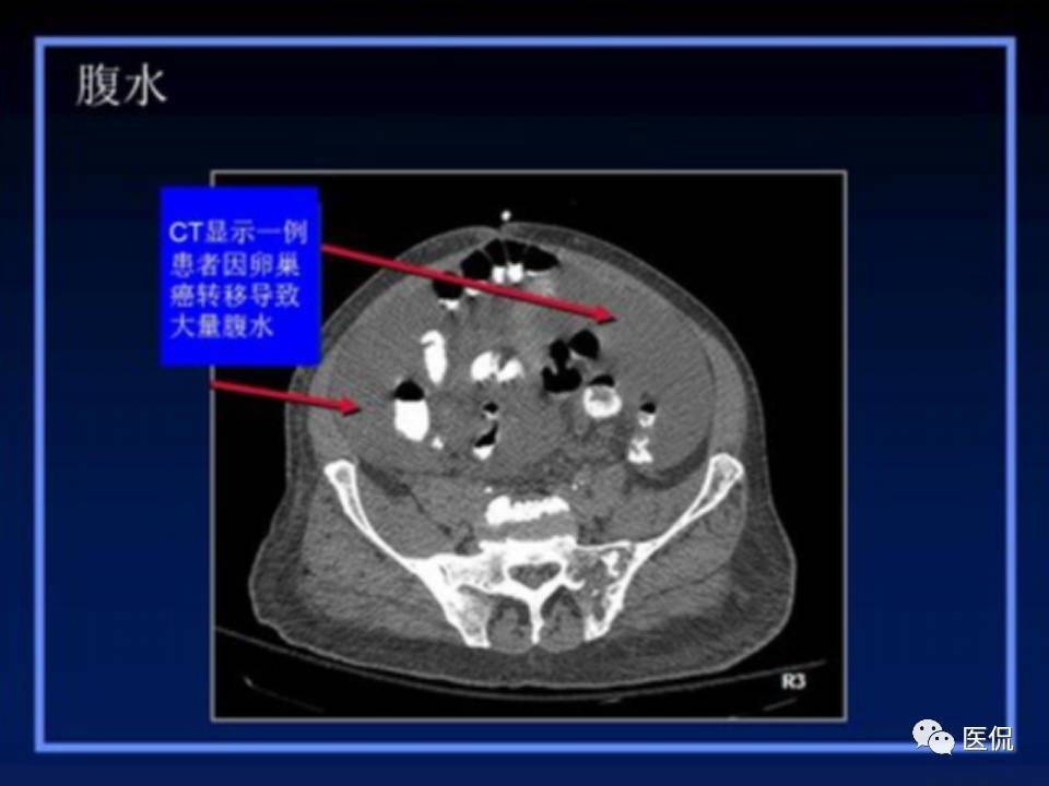 (医学ppt课件大全)(医学ppt模板免费)