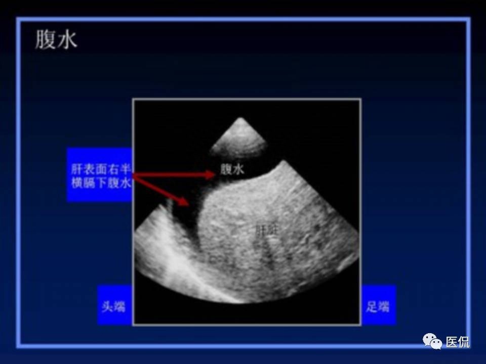 (医学ppt课件大全)(医学ppt模板免费)