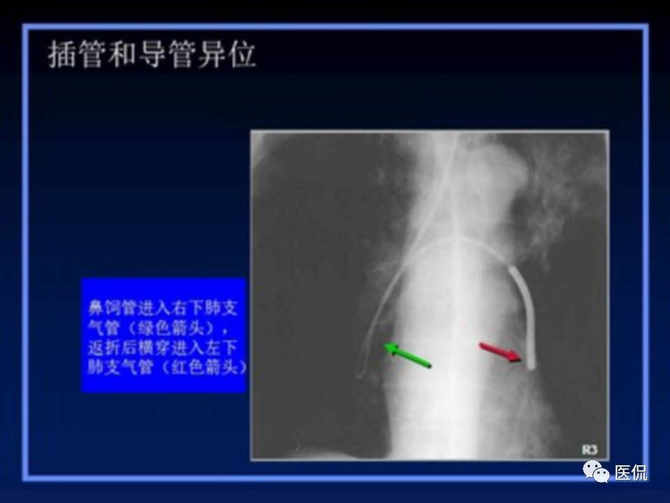 (医学ppt课件大全)(医学ppt模板免费)