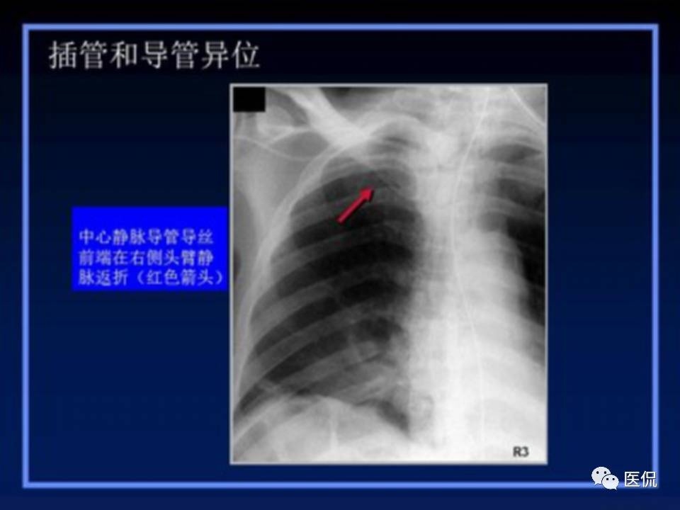 (医学ppt课件大全)(医学ppt模板免费)