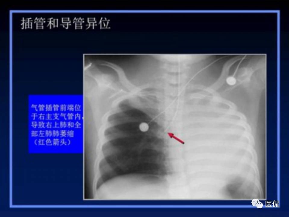 (医学ppt课件大全)(医学ppt模板免费)