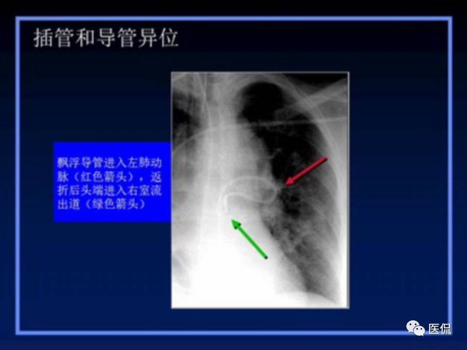 (医学ppt课件大全)(医学ppt模板免费)