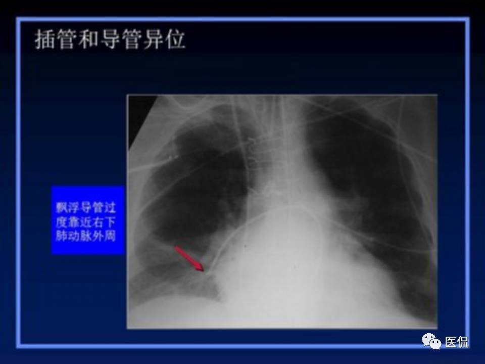 (医学ppt课件大全)(医学ppt模板免费)