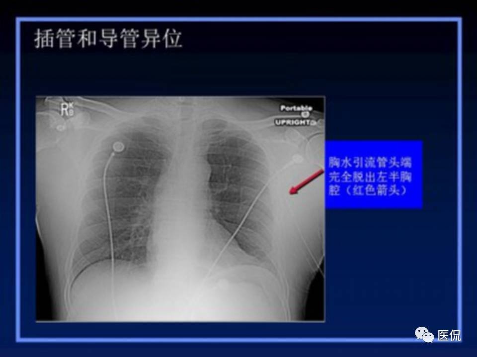 (医学ppt课件大全)(医学ppt模板免费)