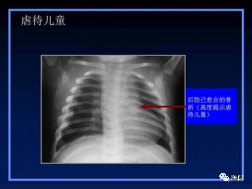 (医学ppt课件大全)(医学ppt模板免费)