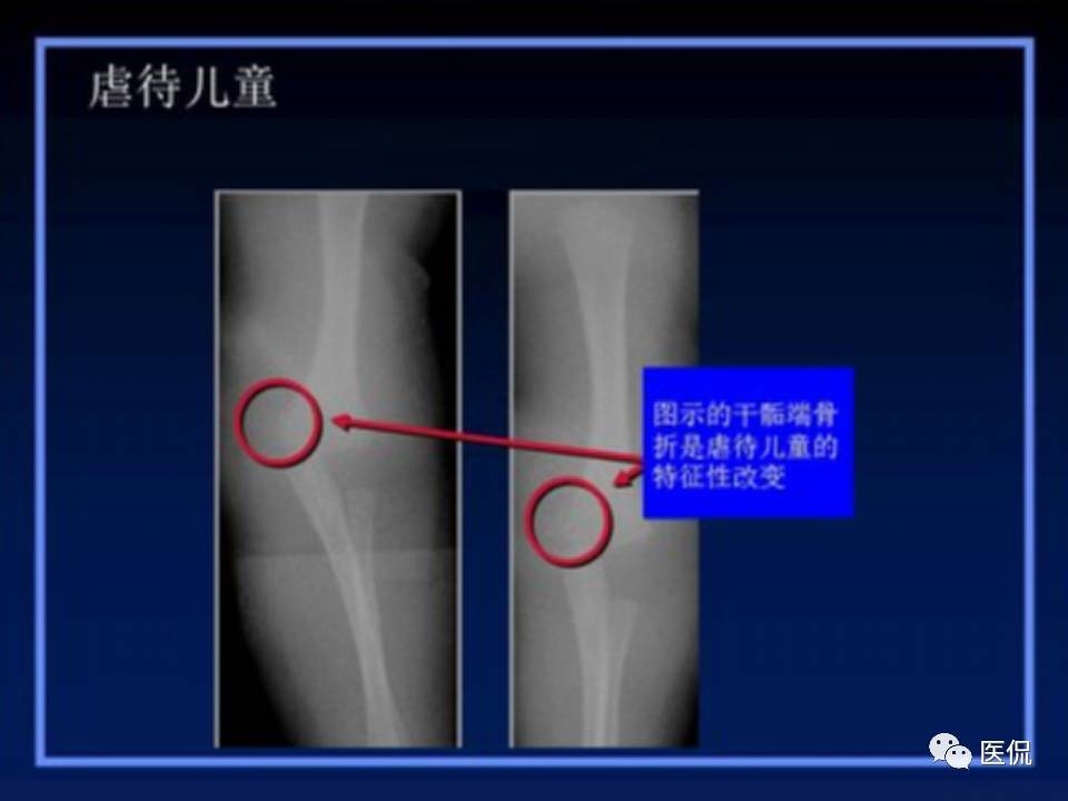 (医学ppt课件大全)(医学ppt模板免费)