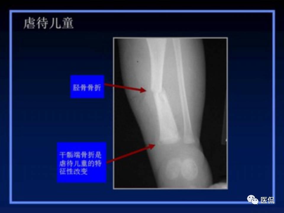 (医学ppt课件大全)(医学ppt模板免费)