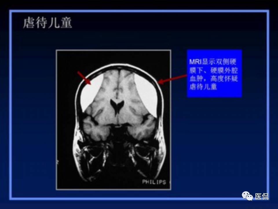 (医学ppt课件大全)(医学ppt模板免费)