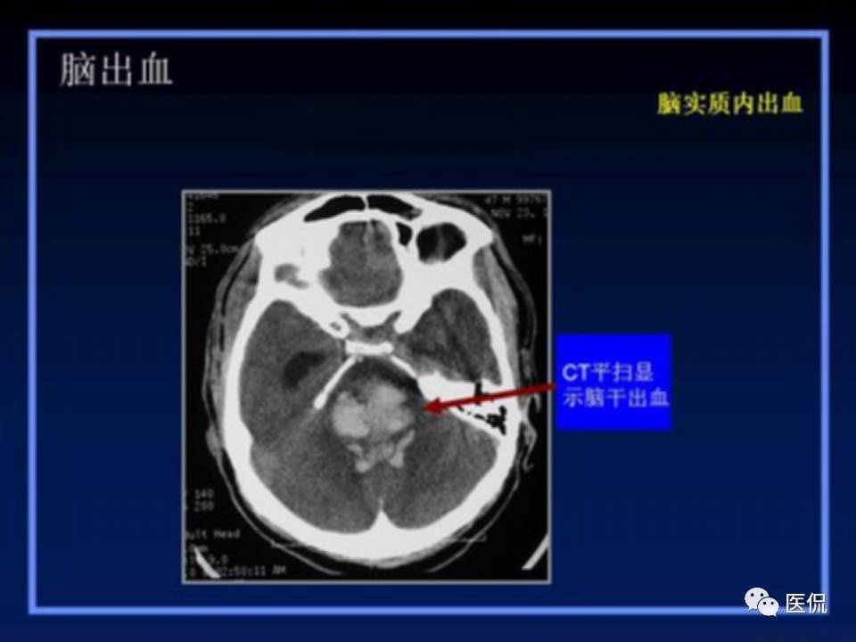 (医学ppt课件大全)(医学ppt模板免费)