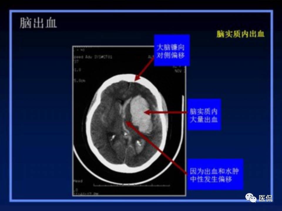 (医学ppt课件大全)(医学ppt模板免费)