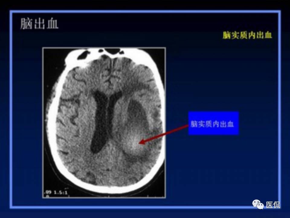 (医学ppt课件大全)(医学ppt模板免费)