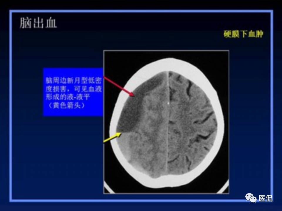 (医学ppt课件大全)(医学ppt模板免费)