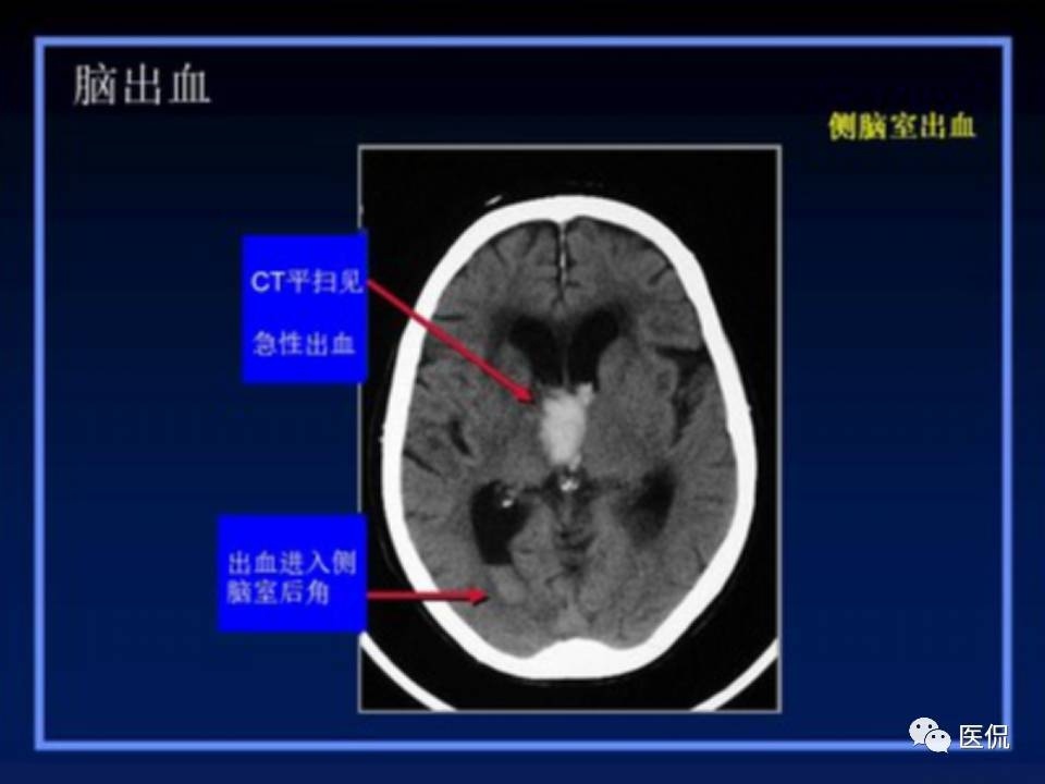 (医学ppt课件大全)(医学ppt模板免费)