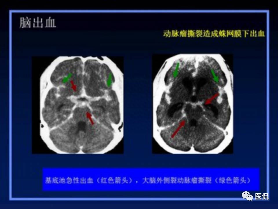 (医学ppt课件大全)(医学ppt模板免费)