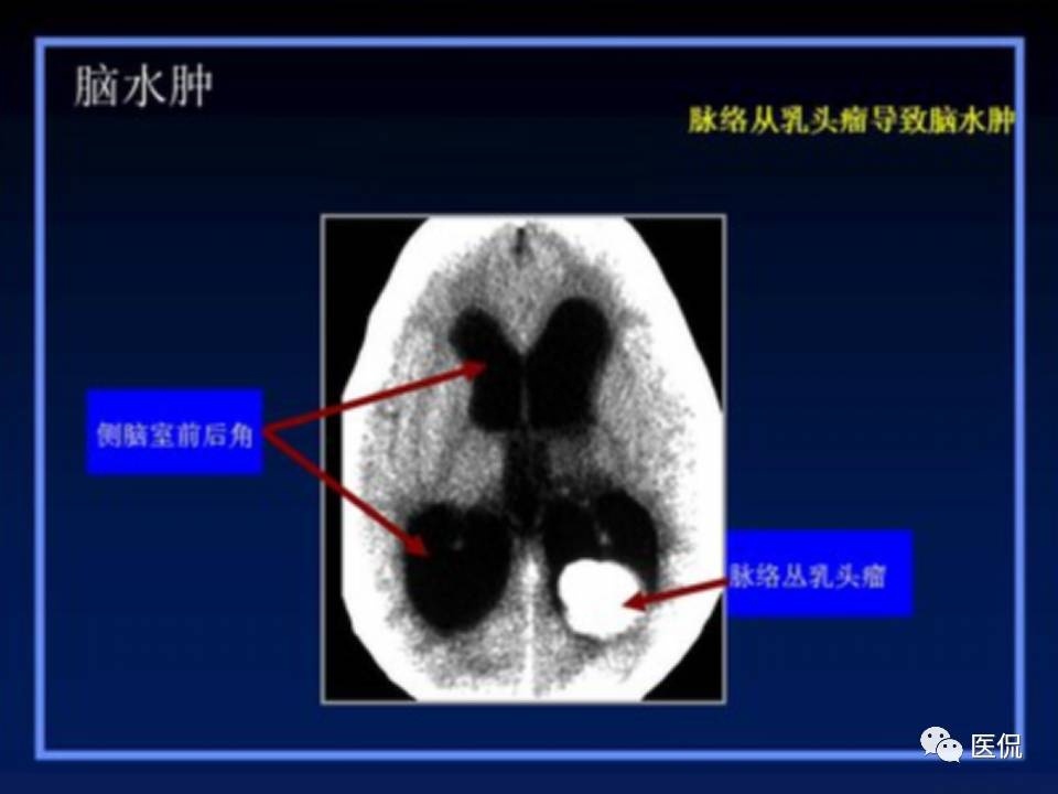 (医学ppt课件大全)(医学ppt模板免费)