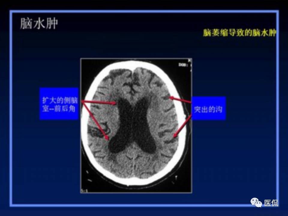 (医学ppt课件大全)(医学ppt模板免费)